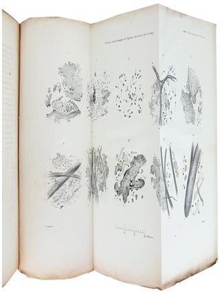 Examen Microscopique du sperme desseche sur le linge, ou sur les tissues de nature et de coloration diverses