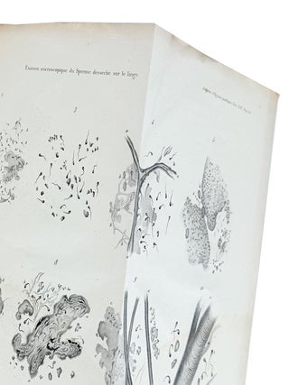 Examen Microscopique du sperme desseche sur le linge, ou sur les tissues de nature et de coloration diverses